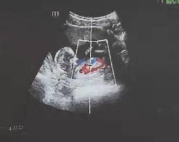 journal_insert_pic_1674605081