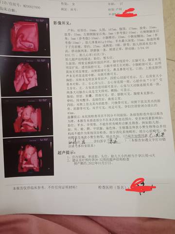 journal_insert_pic_1678336408