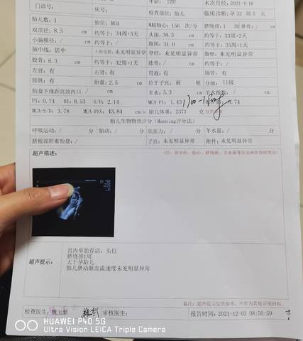 journal_insert_pic_1673048722