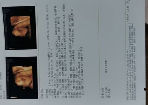 journal_insert_pic_1687297886