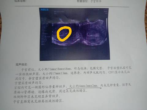 journal_insert_pic_1719391048