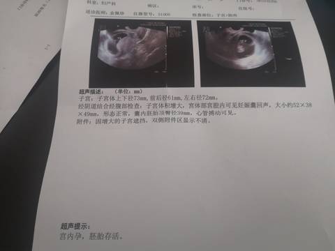 journal_insert_pic_1675991737