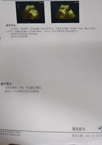 journal_insert_pic_1683452219