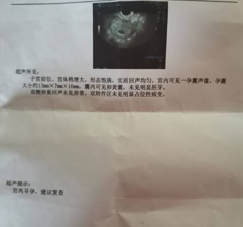 journal_insert_pic_1683630052