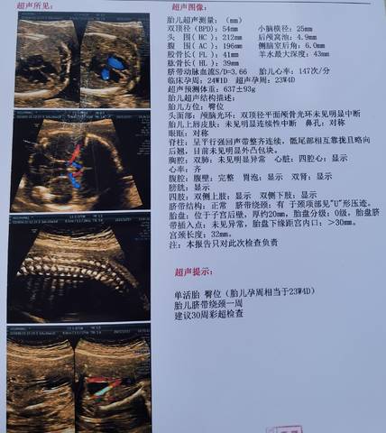 journal_insert_pic_1687325479
