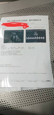 journal_insert_pic_1720008673