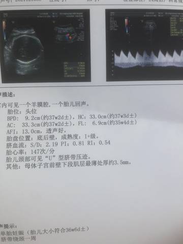 journal_insert_pic_1686539237