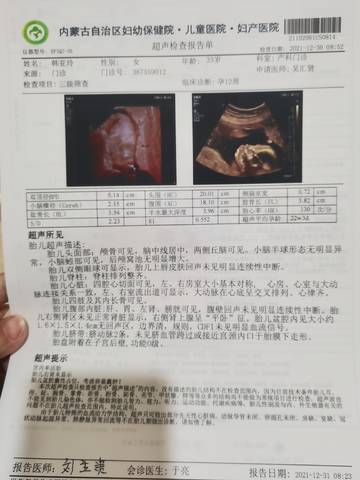 journal_insert_pic_1689500351