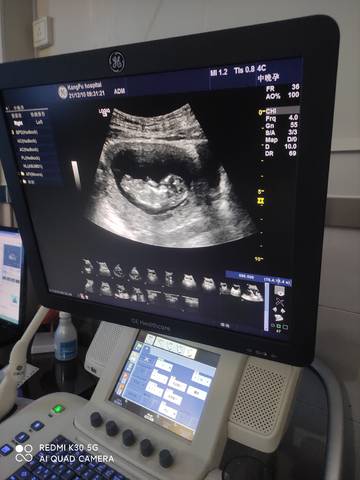 journal_insert_pic_1677541663