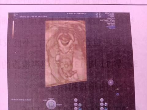 journal_insert_pic_1677456735