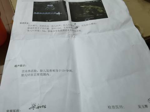 journal_insert_pic_1684910834