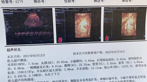 journal_insert_pic_1676717156
