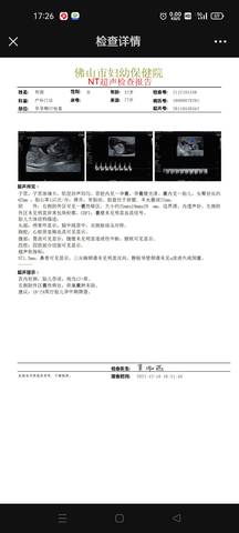 journal_insert_pic_1677526023