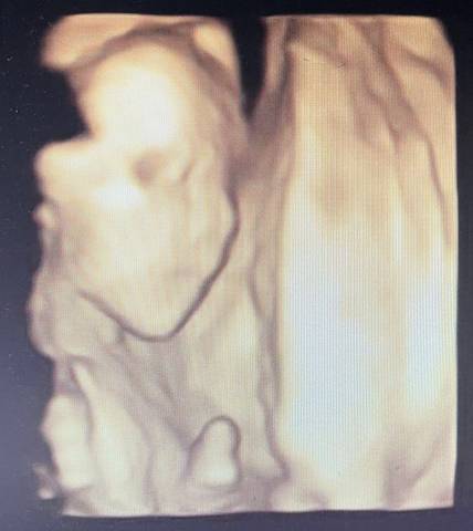 journal_insert_pic_1674890810