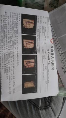 journal_insert_pic_1679300320