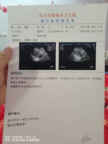 journal_insert_pic_1675088027