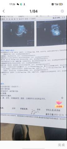 journal_insert_pic_1689636573