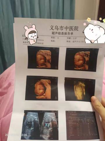 journal_insert_pic_1678210921