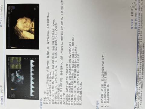 journal_insert_pic_1688029619