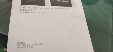 journal_insert_pic_1674273543