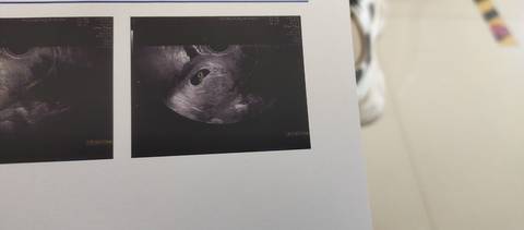 journal_insert_pic_1689548635