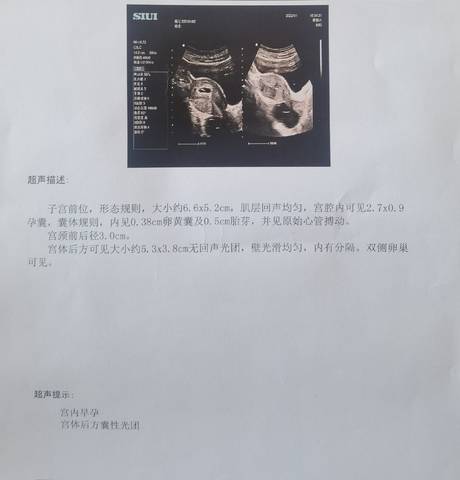 journal_insert_pic_1690208336