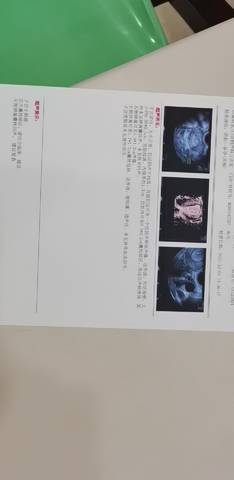 journal_insert_pic_1673608699