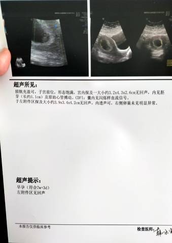 journal_insert_pic_1740888037