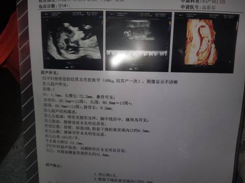 journal_insert_pic_1684407349