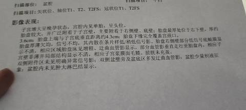 journal_insert_pic_1684295501