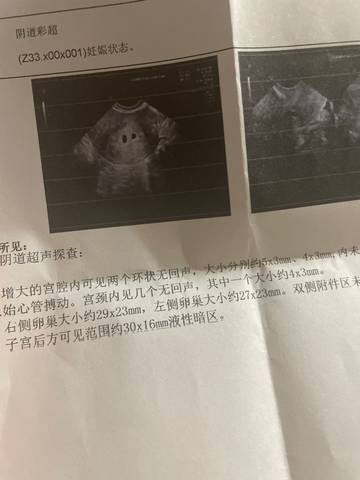 journal_insert_pic_1675034285
