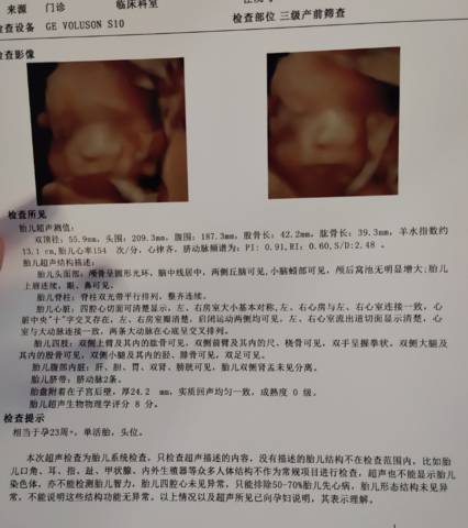 journal_insert_pic_1690077365