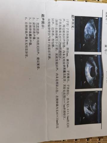 journal_insert_pic_1685478832