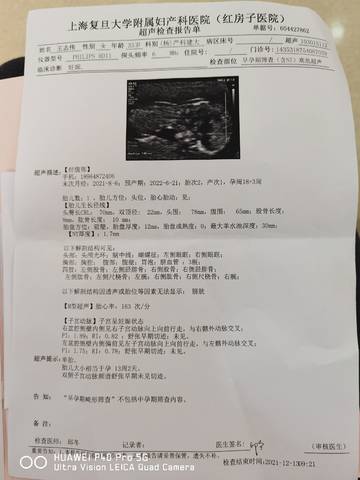 journal_insert_pic_1682526876