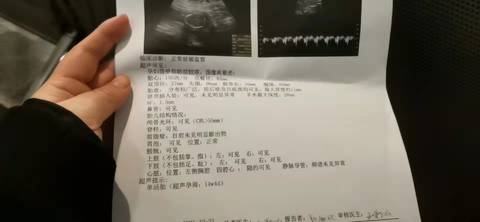 journal_insert_pic_1683487047