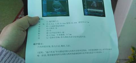 journal_insert_pic_1675145743