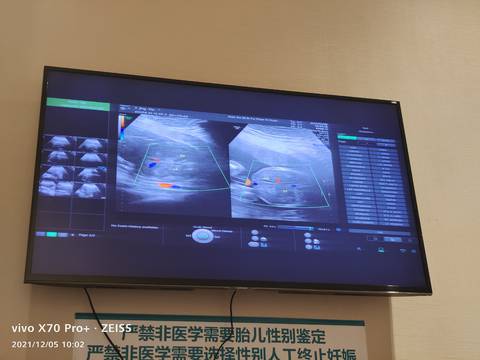 journal_insert_pic_1674290295