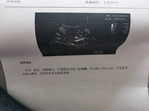 journal_insert_pic_1684594233
