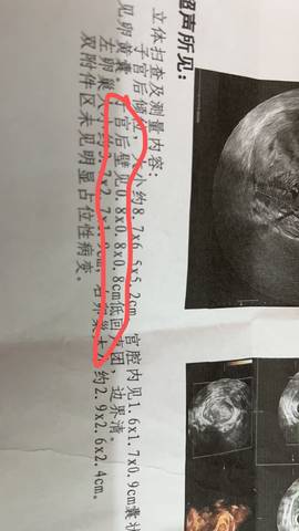 journal_insert_pic_1719563310