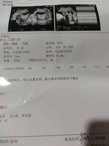 journal_insert_pic_1687847350