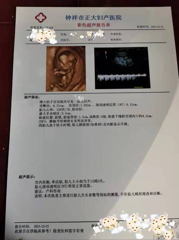 journal_insert_pic_1680175253