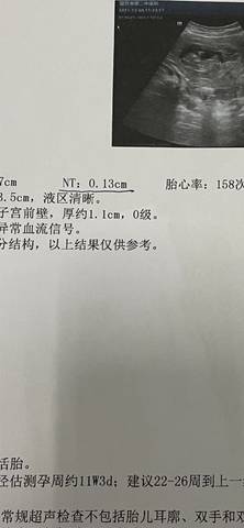 journal_insert_pic_1674889712