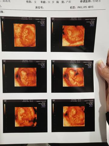 journal_insert_pic_1676930190