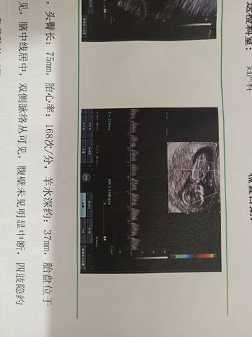 journal_insert_pic_1674316180
