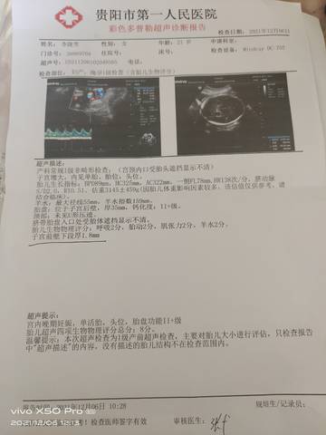 journal_insert_pic_1674986660