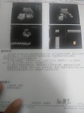 journal_insert_pic_1678152756