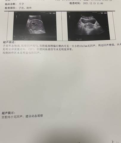 journal_insert_pic_1681013812