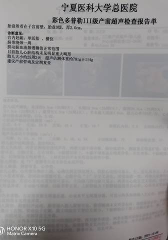 journal_insert_pic_1677078070