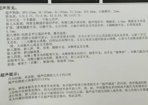 journal_insert_pic_1690534080