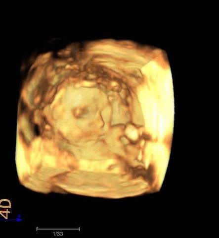 journal_insert_pic_1685153869